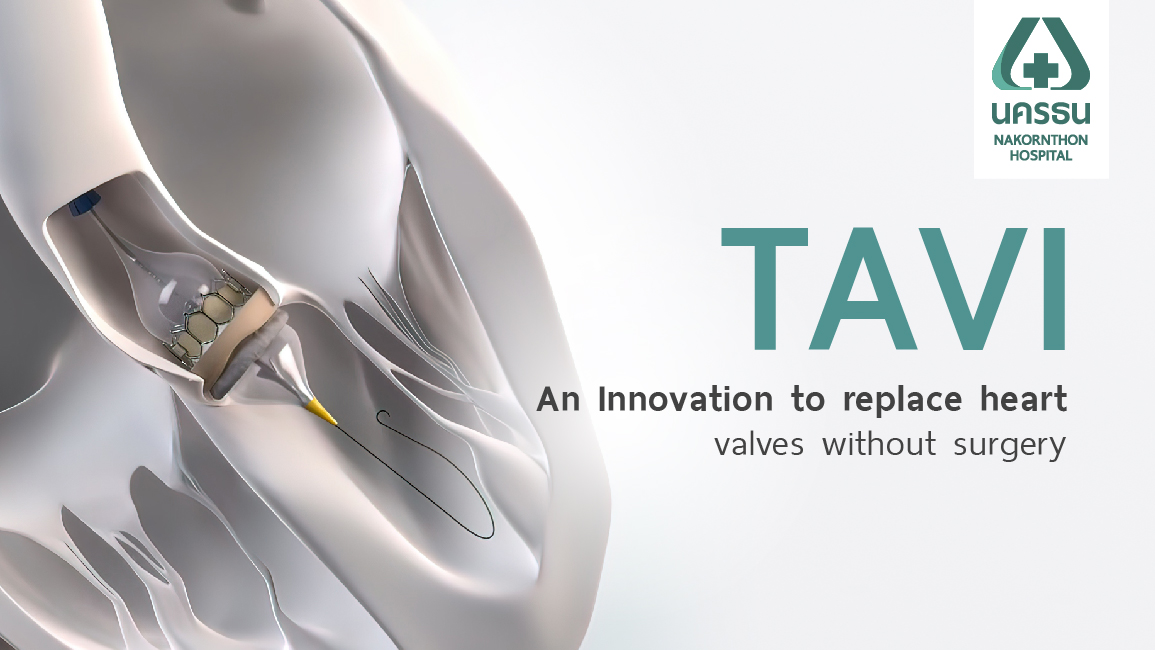 Transcatheter valve replacement (TAVI) and biplane techniques reduce pain without surgical scars